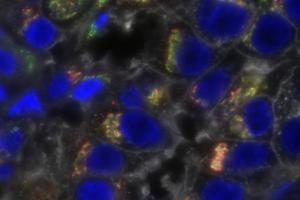 breast cancer cells with stained organelles.